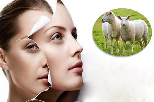 Tác dụng của nhau thai cừu trong sức khỏe và làm đẹp-1